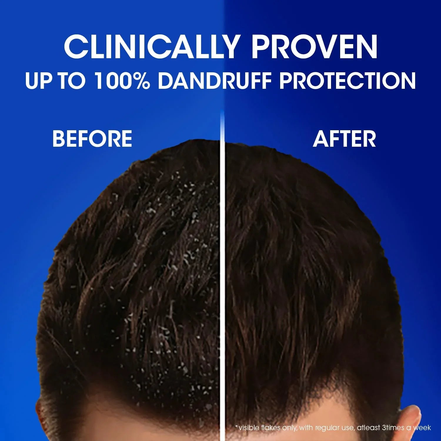 Head & Shoulders Cool Menthol Anti Dandruff Shampoo for Women & Men, 1L - view 7
