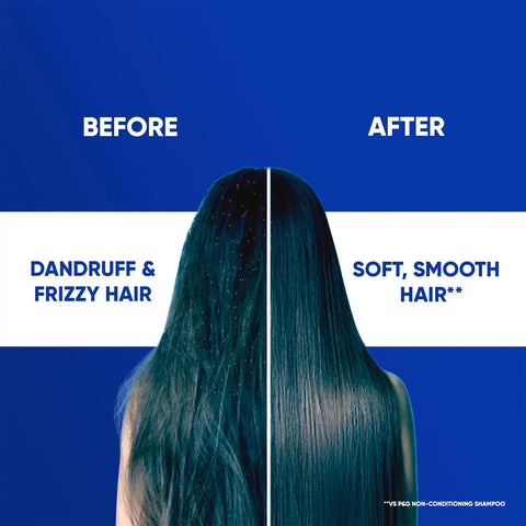 Head & Shoulders 2-in-1 Smooth and Silky Anti Dandruff Shampoo + Conditioner - view 5