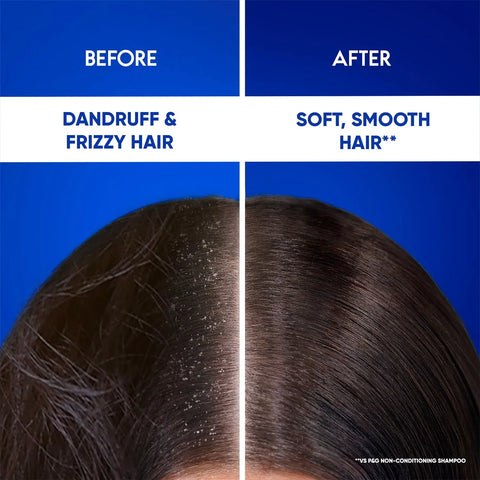 Head & Shoulders 2-in-1 Smooth and Silky Anti Dandruff Shampoo + Conditioner - view 6